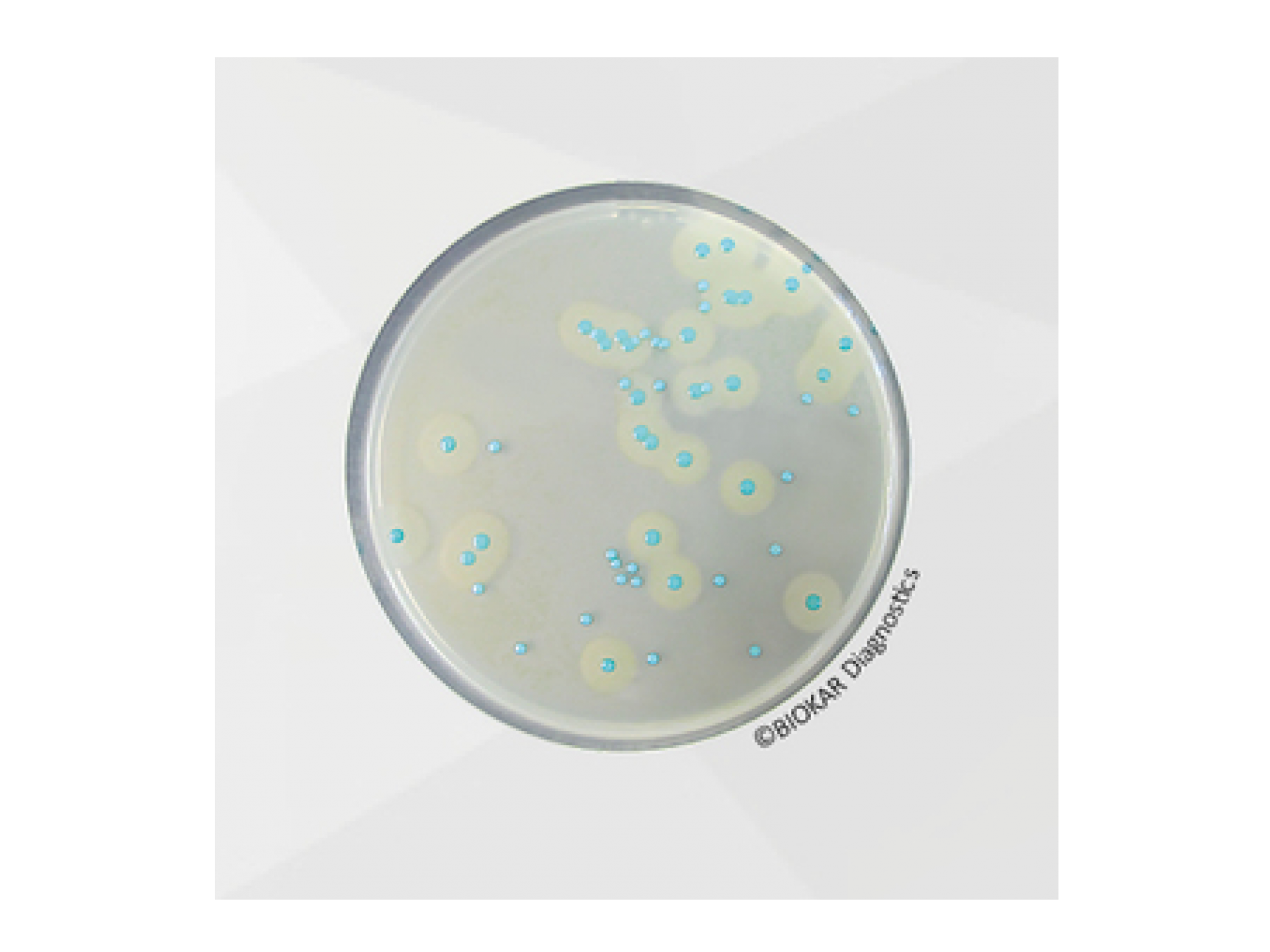 Product in de kijker:  Biokar Compass Listeria agar.