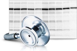 Bio-Rad. Troubleshooting Western Blots with the Western Blot Doctor